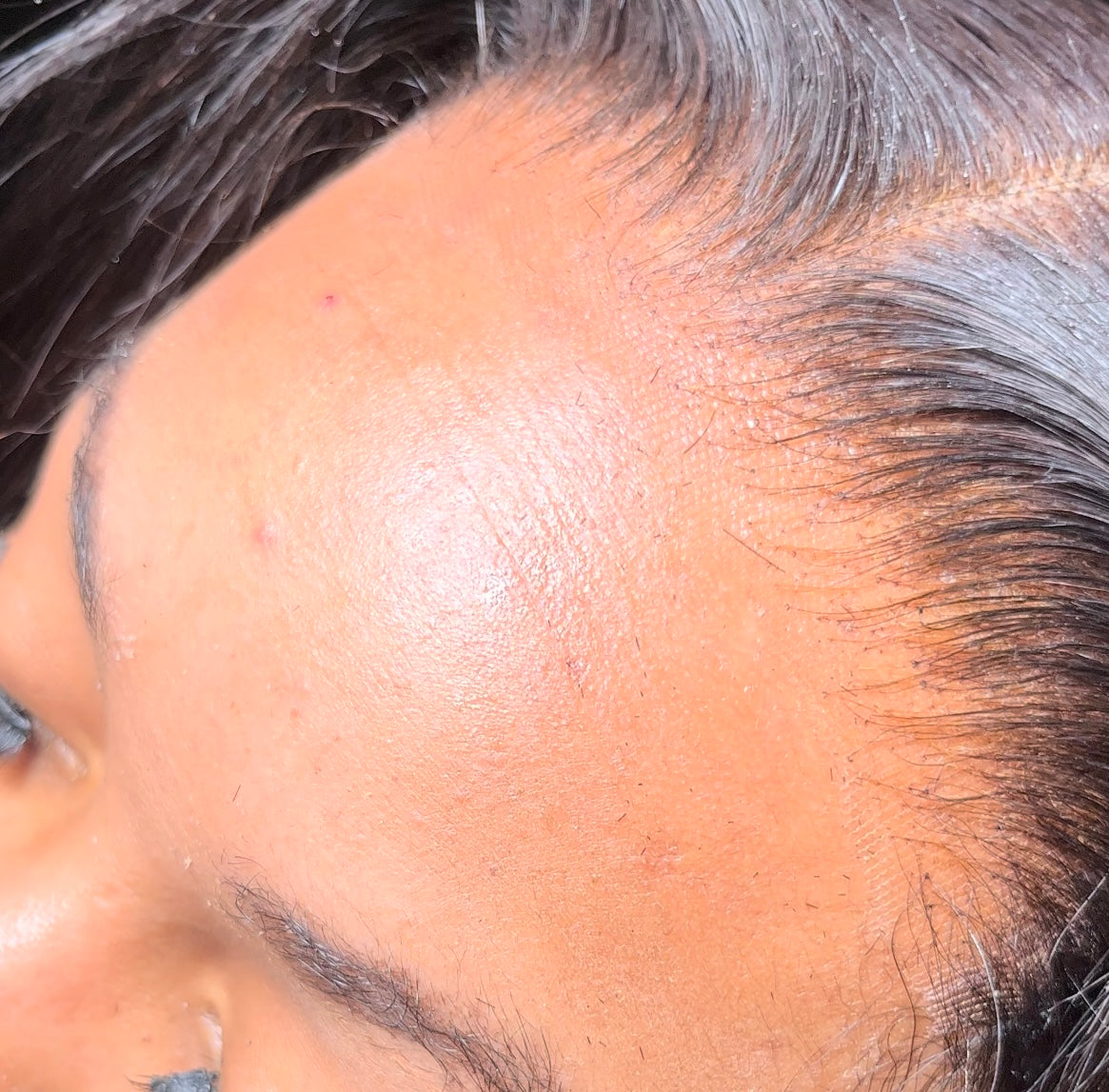 Elite 5by5 HD Lace Closures